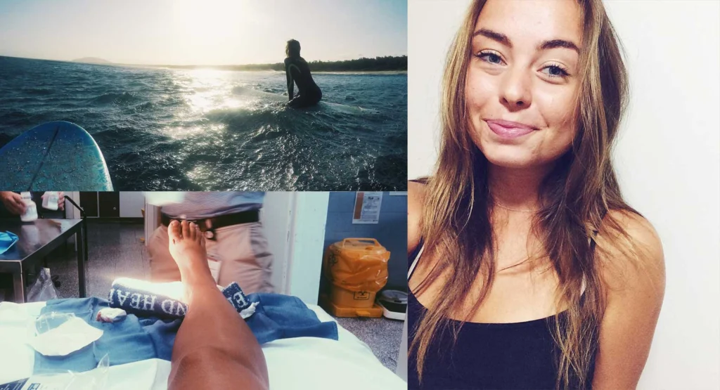 Lisa blev stucken av stingrocka – klarade sig tack vare försäkringen